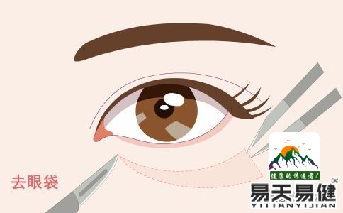 怎么去除眼袋快 可以按摩太阳穴